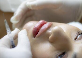 3 reasons to choose lip fillers