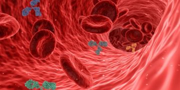 Atherosclerosis: Symptoms, Causes, Diagnosis, and Treatment