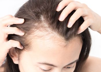 Thinning Hair and Menopause: Embracing Change with Confidence