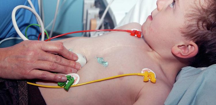 From Prenatal Screening to Heart Transplants: A Guide to Paediatric Cardiology Treatments