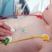 From Prenatal Screening to Heart Transplants: A Guide to Paediatric Cardiology Treatments