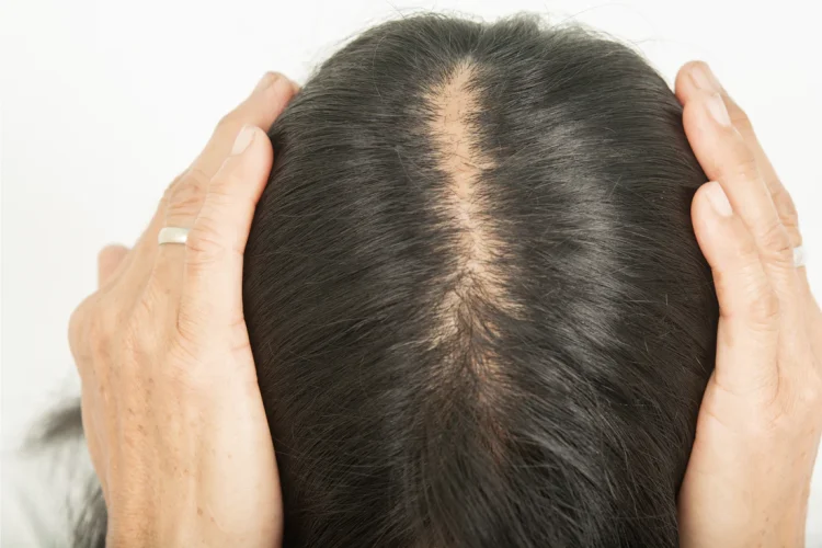 Unlocking Hair Growth Potential: The Benefits of 2-Deoxy-D-Ribose Supplementation