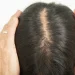 Unlocking Hair Growth Potential: The Benefits of 2-Deoxy-D-Ribose Supplementation