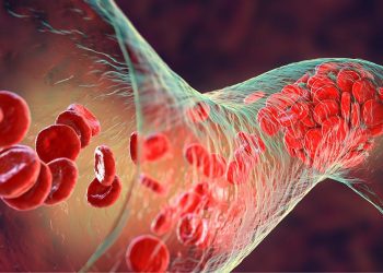 Shedding Light on Blood Clot Charities: Who They Help and How