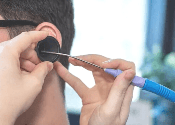 Earwax Microsuction: Safe Removal for Optimal Ear Health
