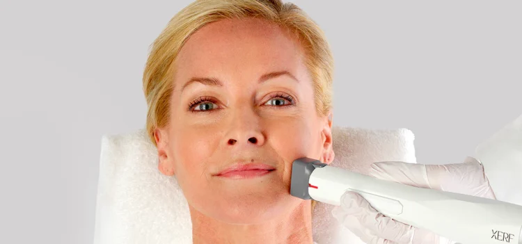 Xerf Treatment Explained: Your Step-by-Step Guide to Results and Recovery